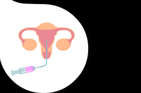 Embryo Transfer Day with Your Surrogate – field-fertility-online